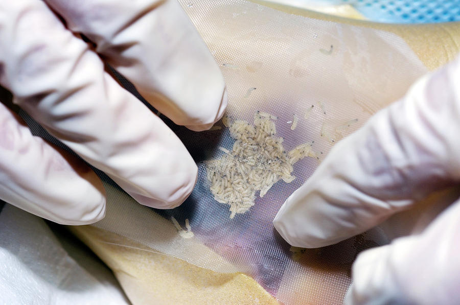 Maggot Therapy #2 Photograph by Louise Murray / Science Photo Library ...