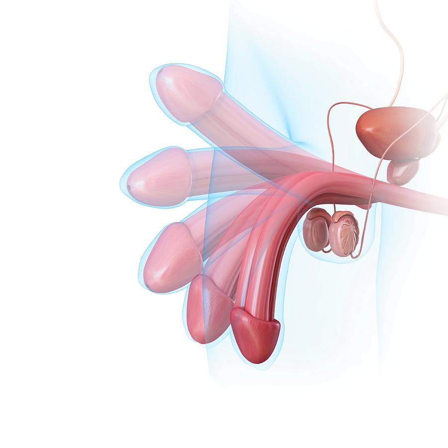 Male Penis Erection Photograph by Pixologicstudio / Science Photo — free download