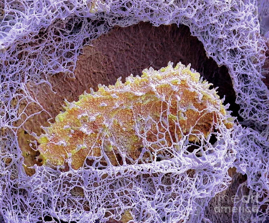 Chondrocyte #2 Photograph by Steve Gschmeissner / Science Photo Library ...