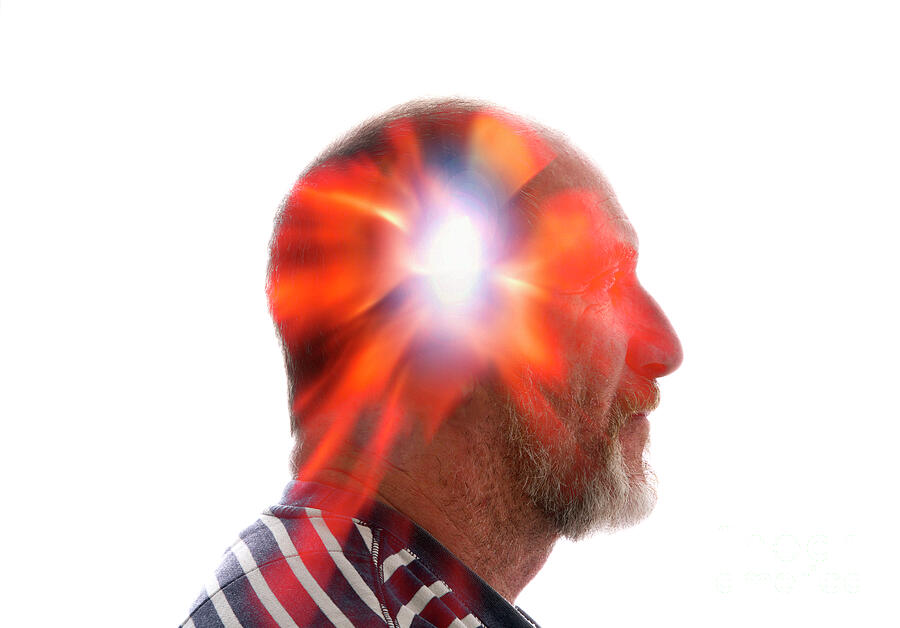 Exploding Head Syndrome #2 Photograph by Victor De Schwanberg / Science ...